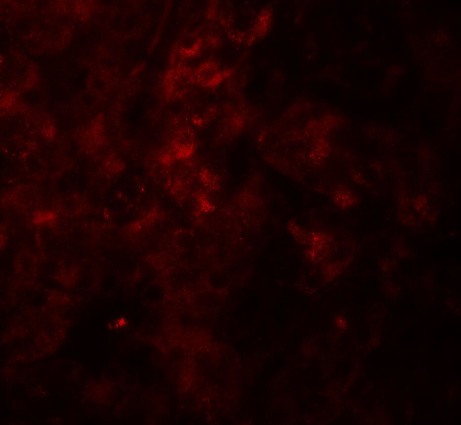 SESN2 Antibody - BSA Free