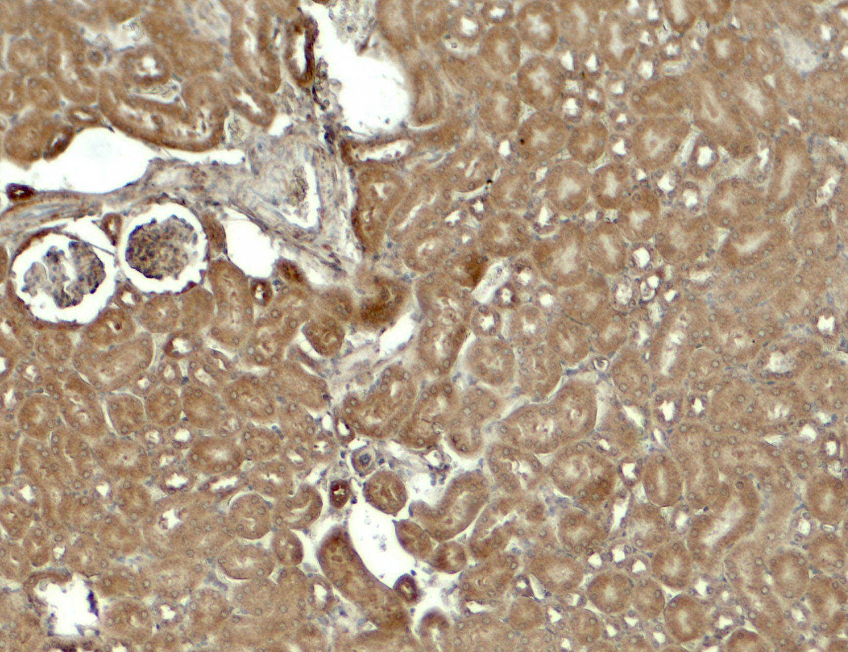 SESN2 Antibody - BSA Free