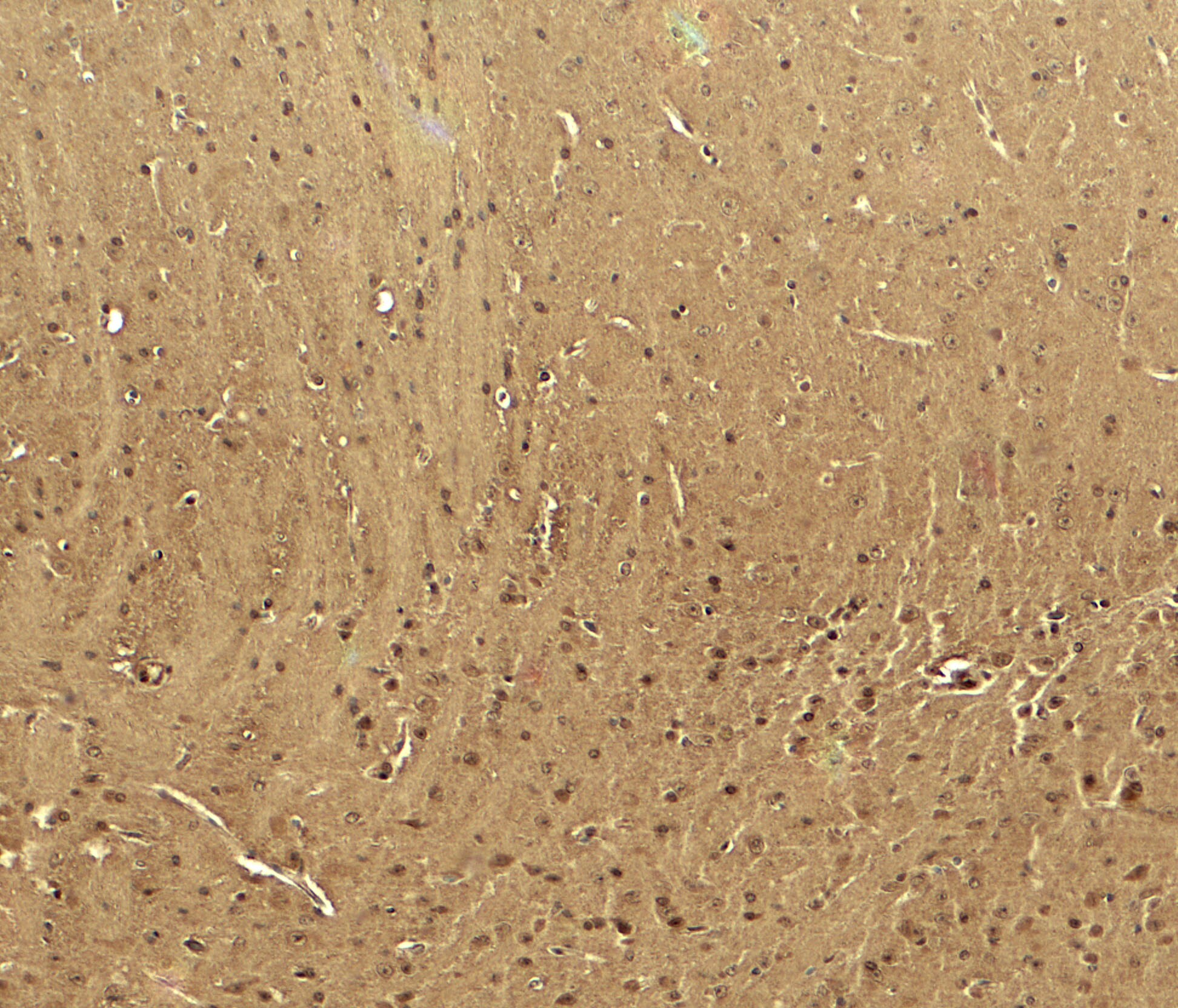 Cav3.2 Antibody - BSA Free