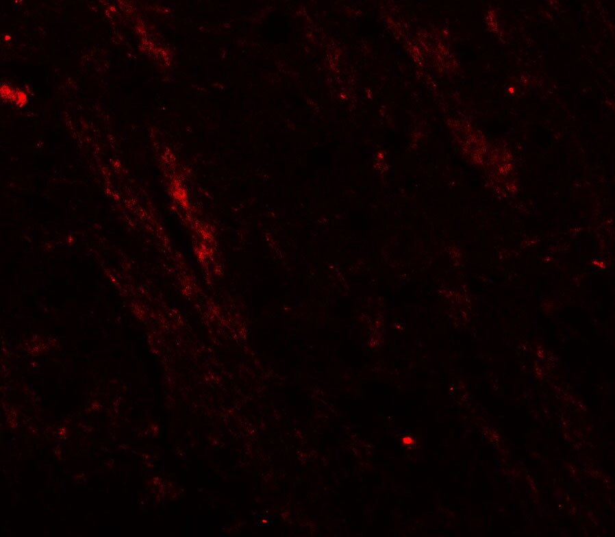 Cav3.2 Antibody - BSA Free