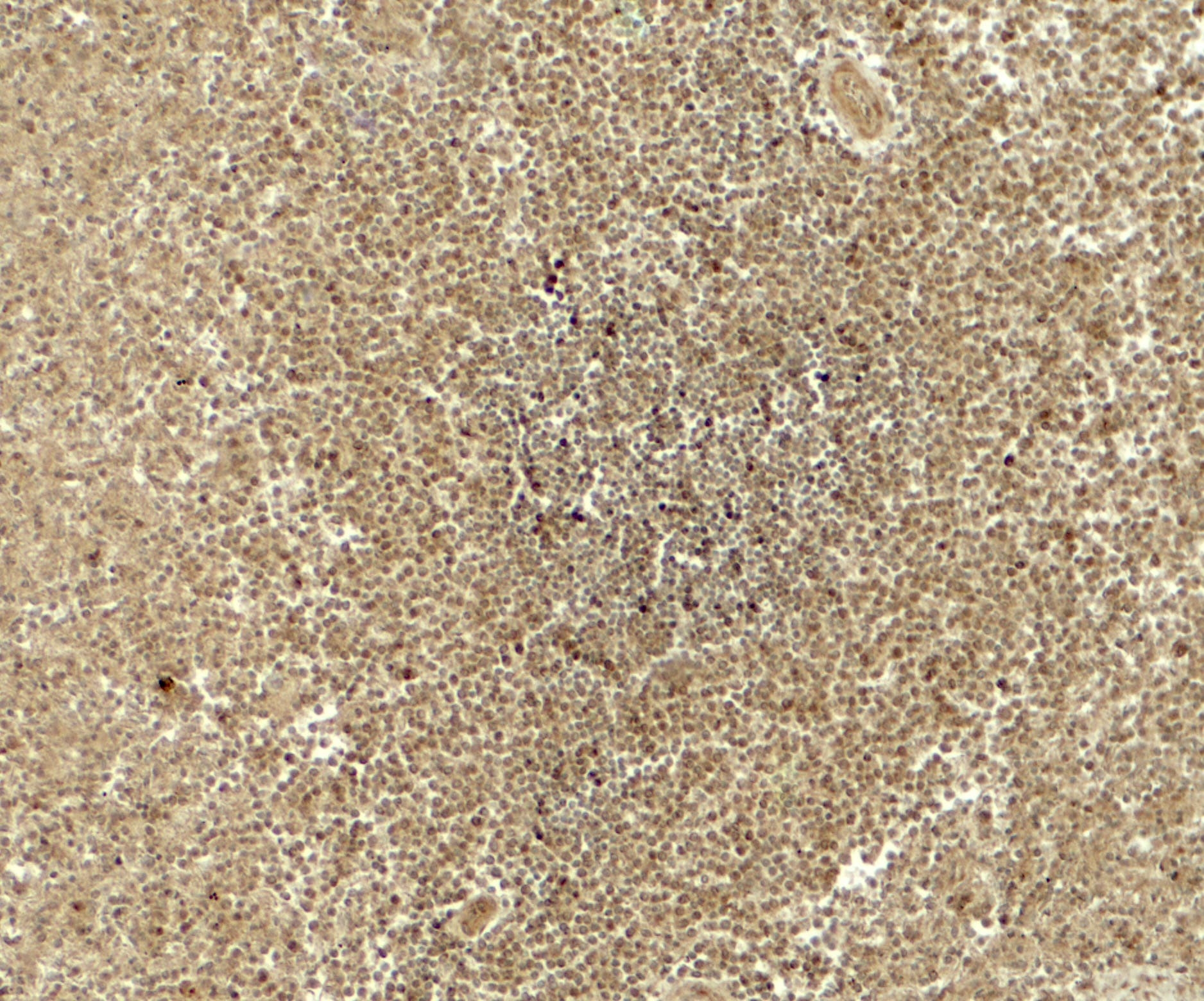 ATG4B Antibody - BSA Free