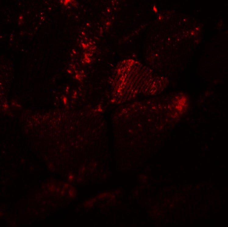 MYH8 Antibody - BSA Free