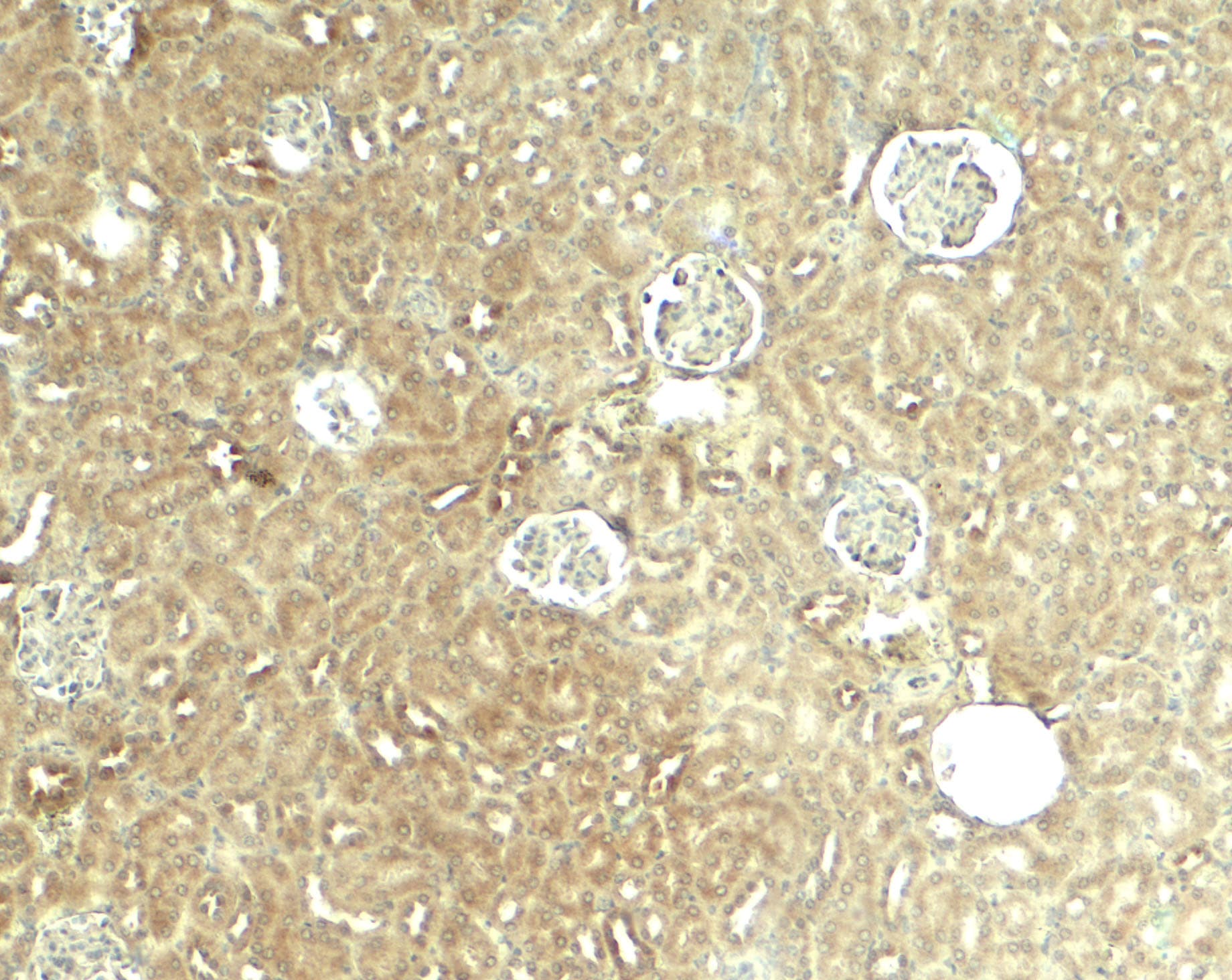 GliS2 Antibody - BSA Free