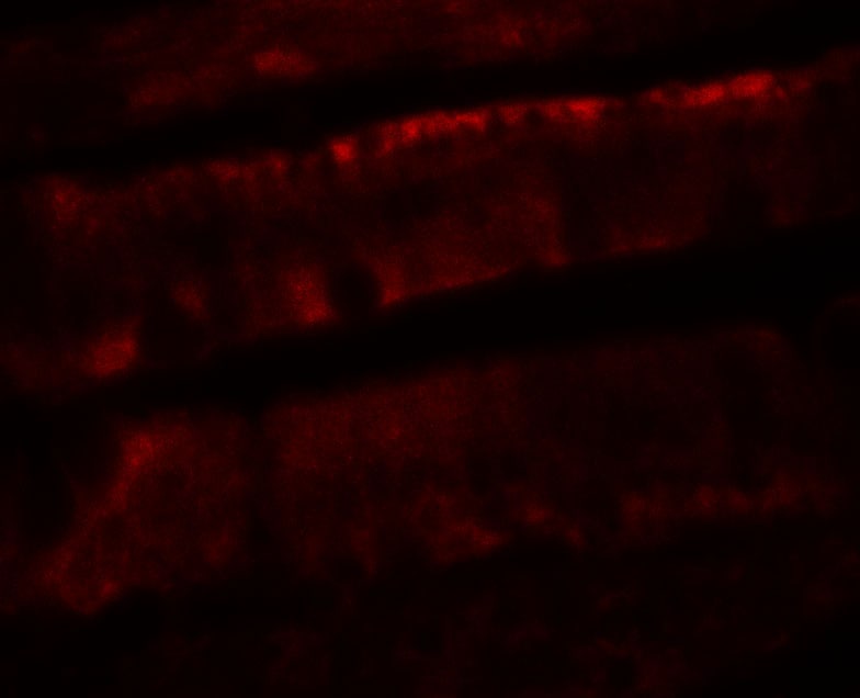 Adenosine A2b R Antibody - BSA Free