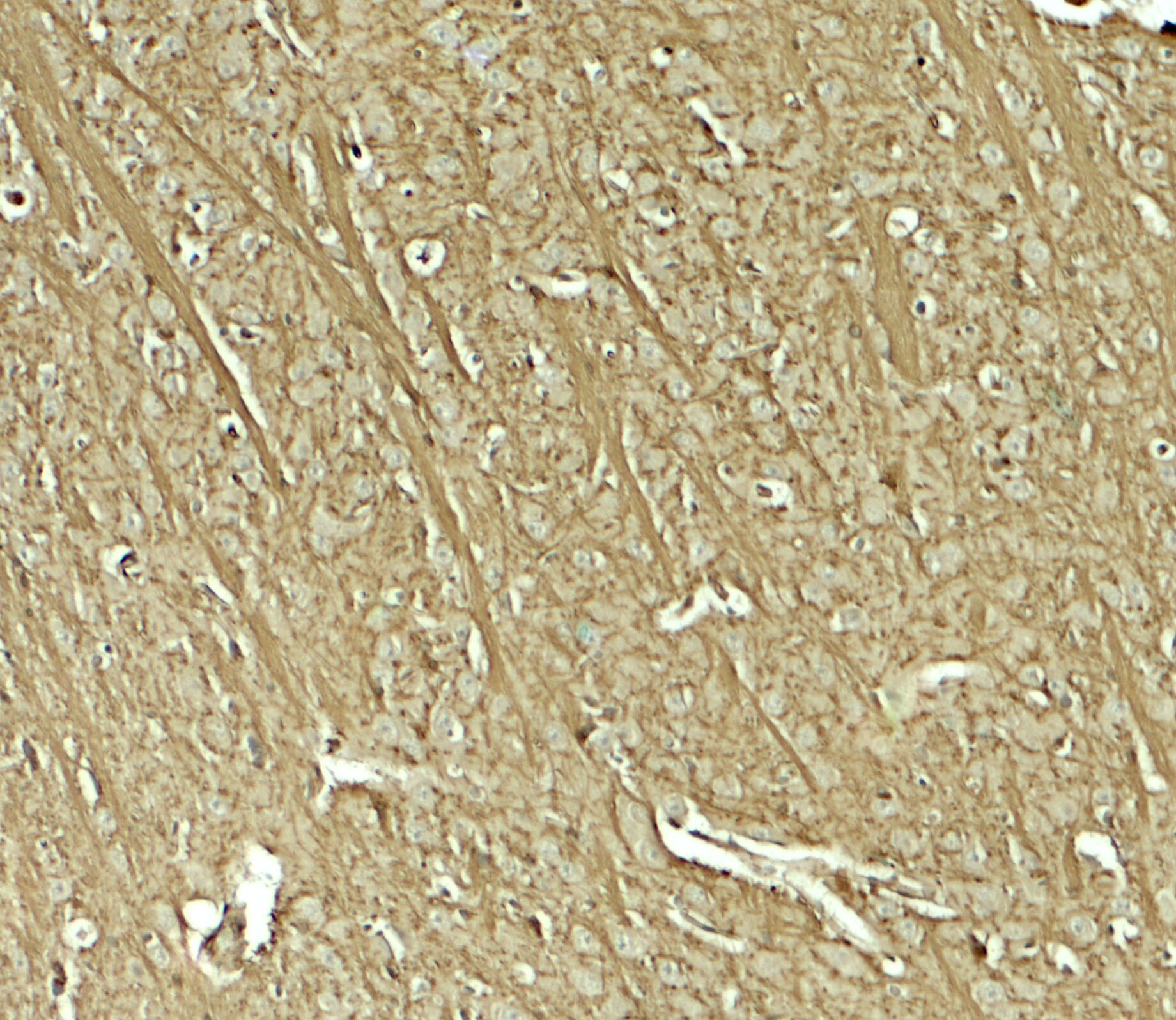 Teneurin-1 Antibody - BSA Free