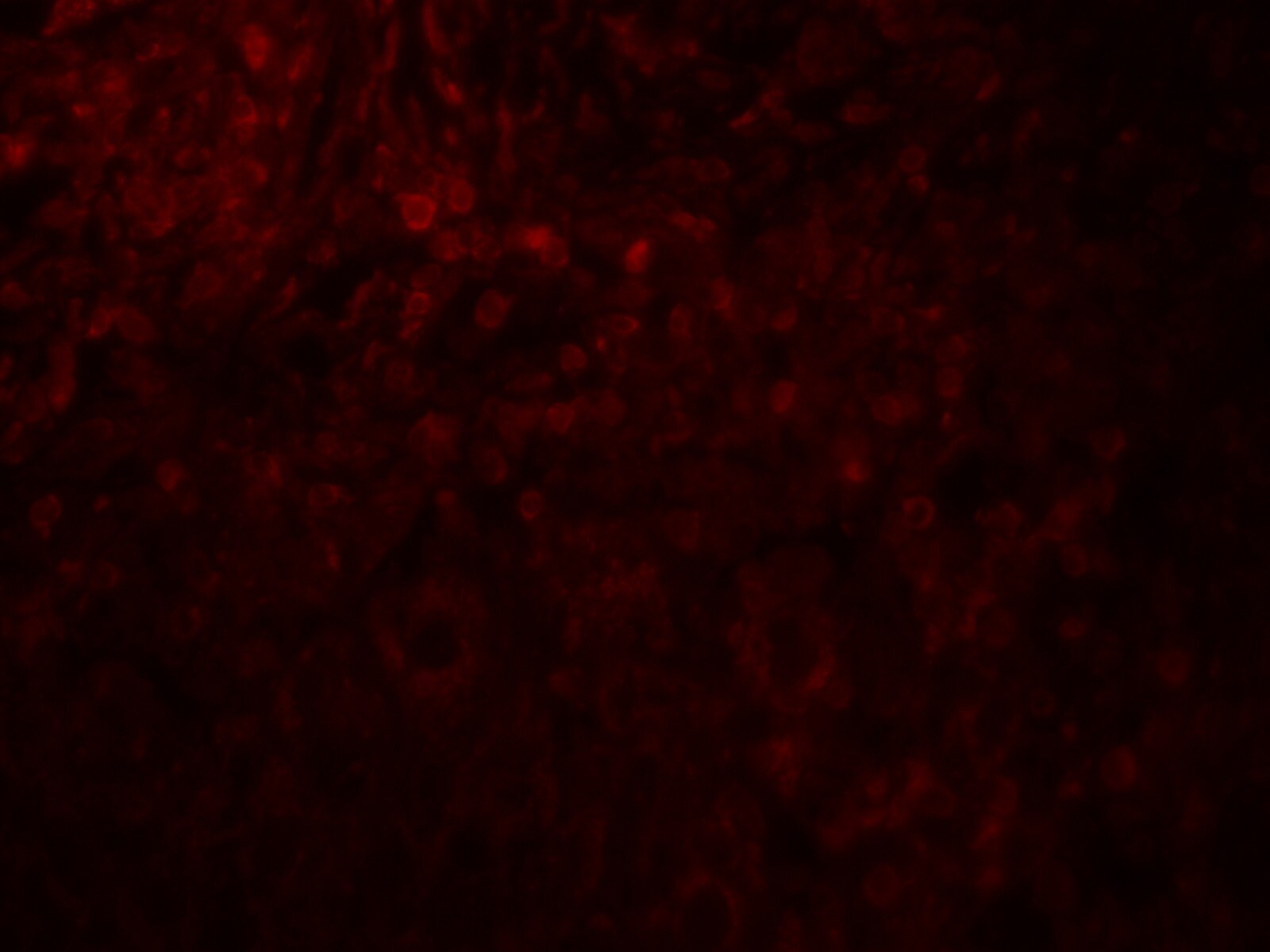 MAGEA4 Antibody - BSA Free