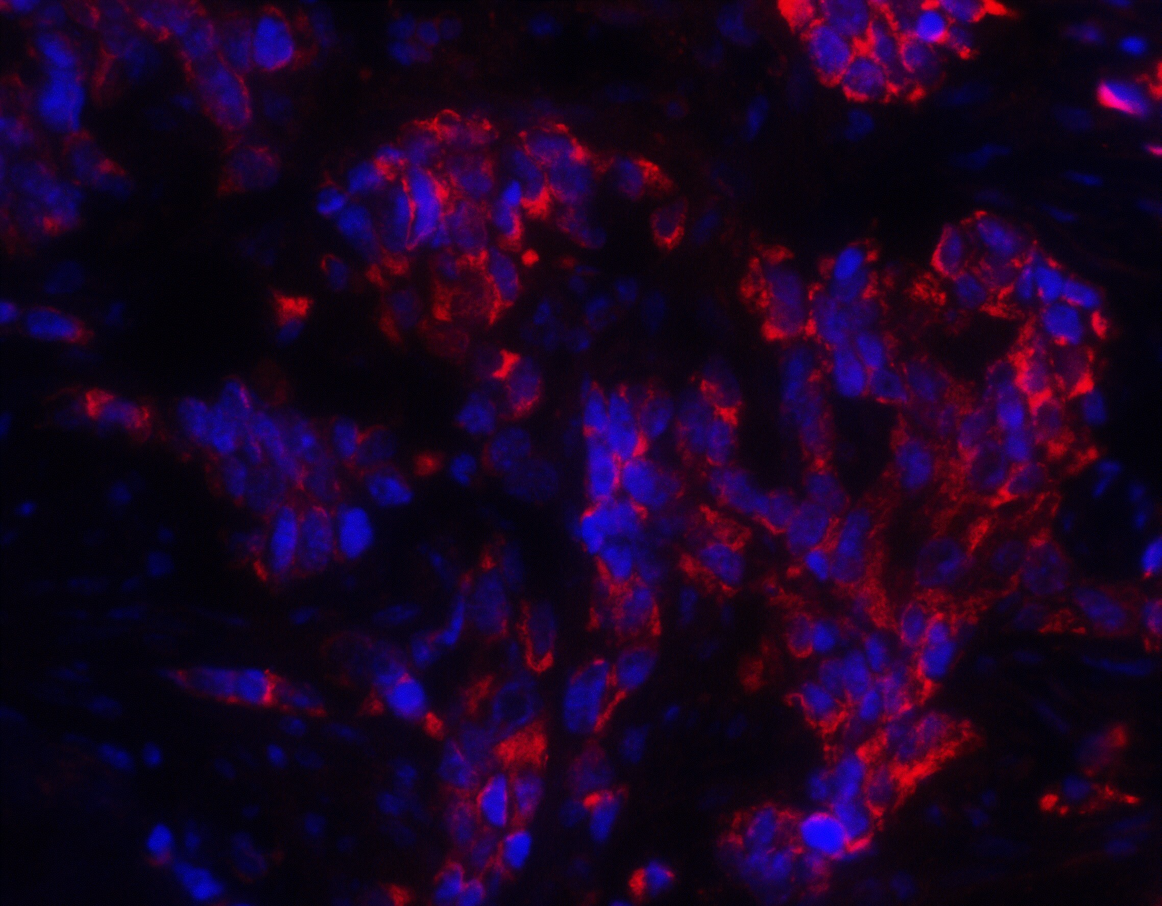 MAGEA4 Antibody - BSA Free
