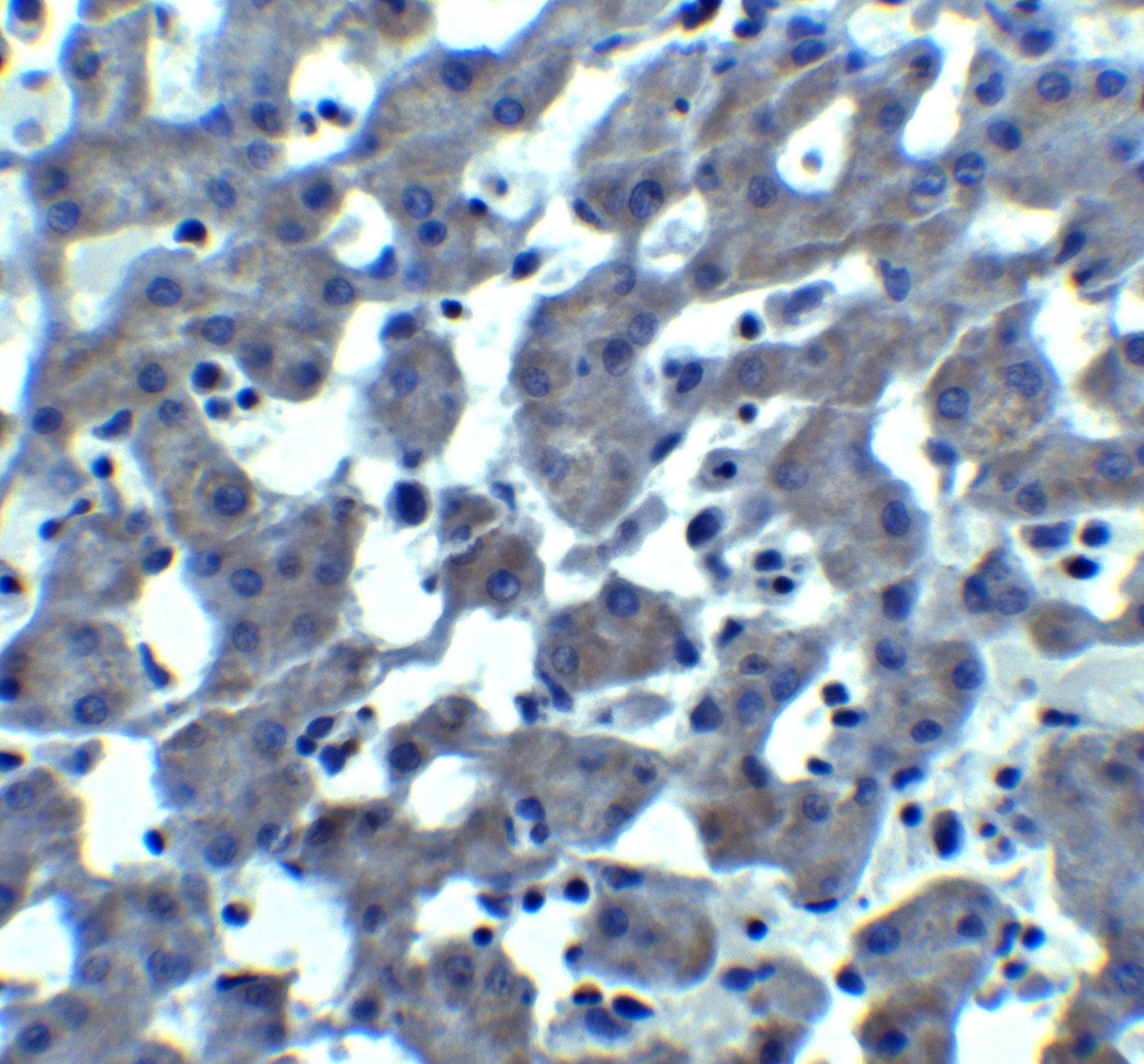 Trophinin Antibody - BSA Free