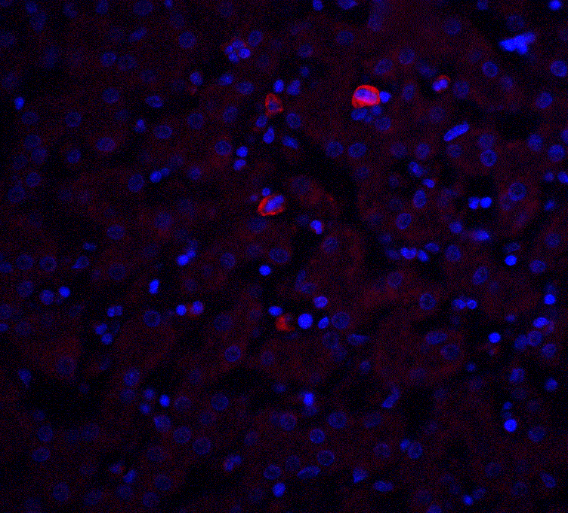Trophinin Antibody - BSA Free