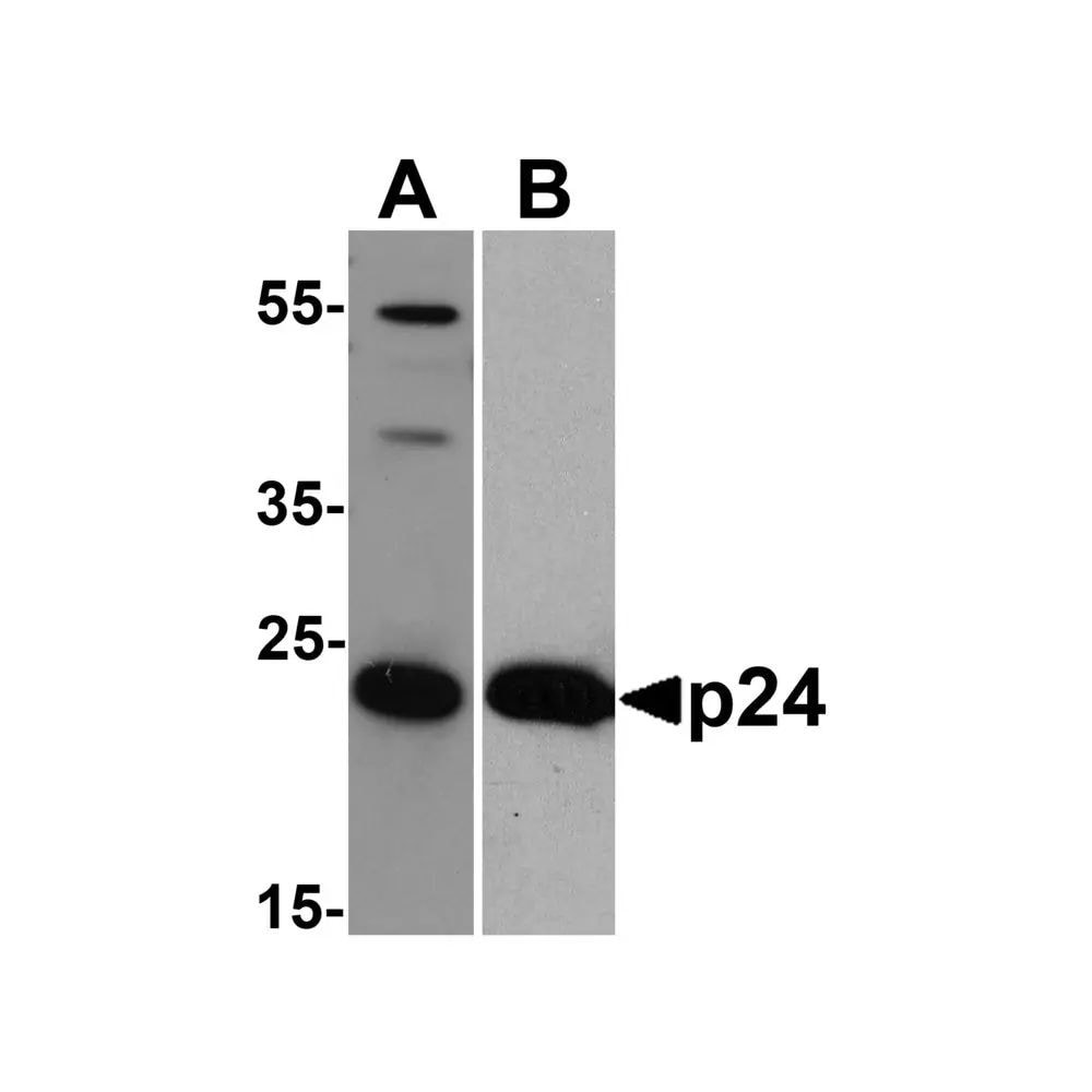 Western Blot: HIV-1 Gag p24 Antibody (8G9)BSA Free [NBP2-41336]
