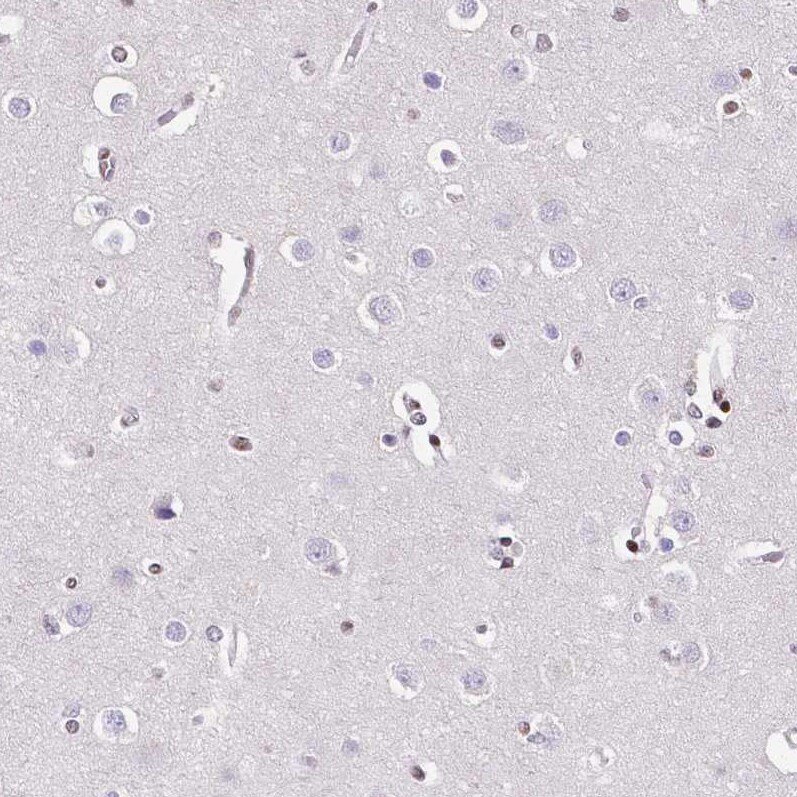 NRSF Antibody (CL0381) - BSA Free Immunohistochemistry: NRSF Antibody (CL0381) - BSA Free [NBP2-42048]