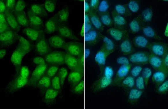 GR/NR3C1 Antibody