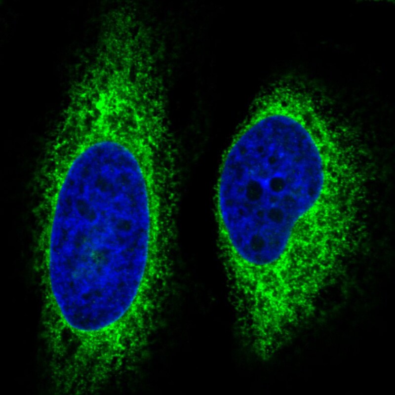 gp96/HSP90B1/GRP94 Antibody (CL2647) - BSA Free Immunocytochemistry/ Immunofluorescence: gp96/HSP90B1/GRP94 Antibody (CL2647) [NBP3-52460]