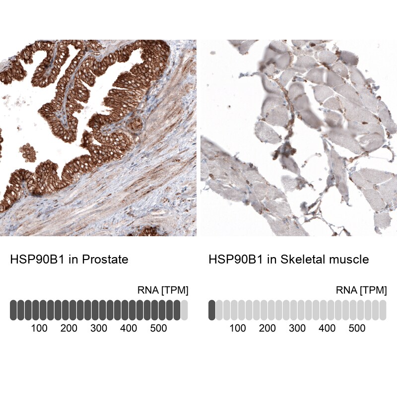 gp96/HSP90B1/GRP94 Antibody (CL2647) - BSA Free Immunohistochemistry: gp96/HSP90B1/GRP94 Antibody (CL2647) [NBP3-52460]