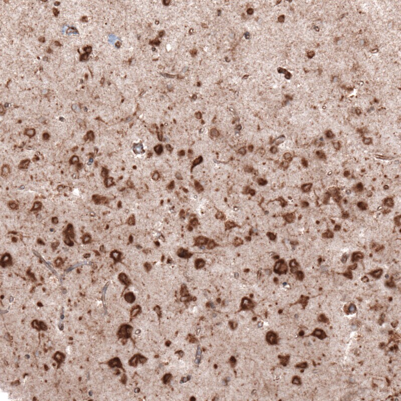 gp96/HSP90B1/GRP94 Antibody (CL2647) - BSA Free Immunohistochemistry: gp96/HSP90B1/GRP94 Antibody (CL2647) [NBP3-52460]