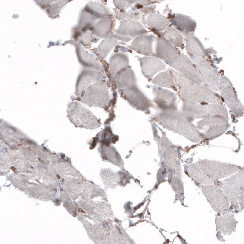 gp96/HSP90B1/GRP94 Antibody (CL2647) - BSA Free Immunohistochemistry: gp96/HSP90B1/GRP94 Antibody (CL2647) [NBP3-52460]
