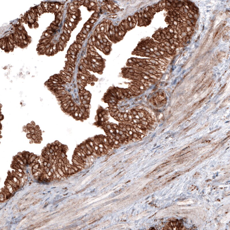 gp96/HSP90B1/GRP94 Antibody (CL2647) - BSA Free Immunohistochemistry: gp96/HSP90B1/GRP94 Antibody (CL2647) [NBP3-52460]