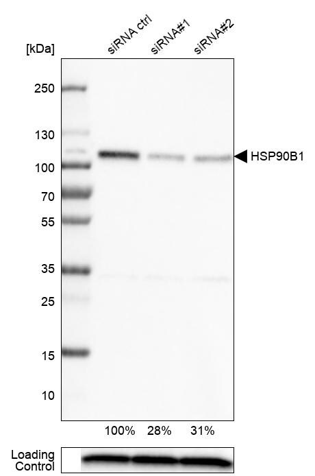 gp96/HSP90B1/GRP94 Antibody (CL2647) - BSA Free Western Blot: gp96/HSP90B1/GRP94 Antibody (CL2647) [NBP3-52460]