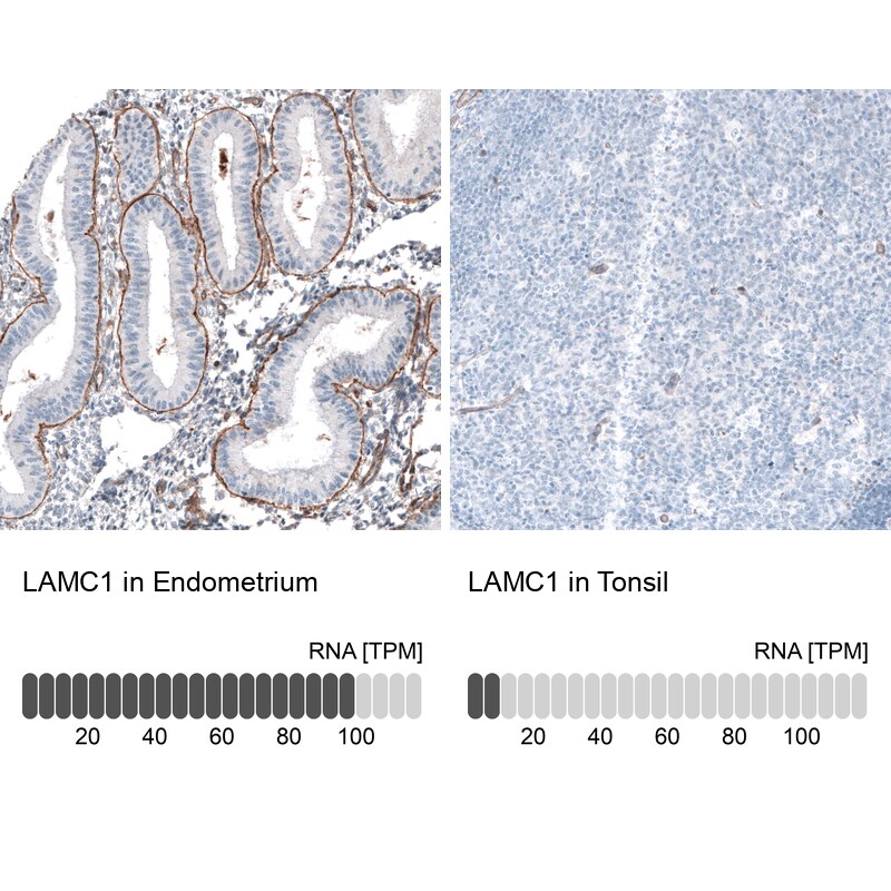 Laminin gamma 1 Antibody (CL3196) - BSA Free Immunohistochemistry: Laminin gamma 1 Antibody (CL3196) [NBP3-52468]
