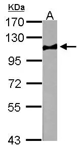 Atpalpha Antibody