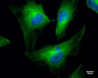 Cofilin Antibody (567) - Azide and BSA Free