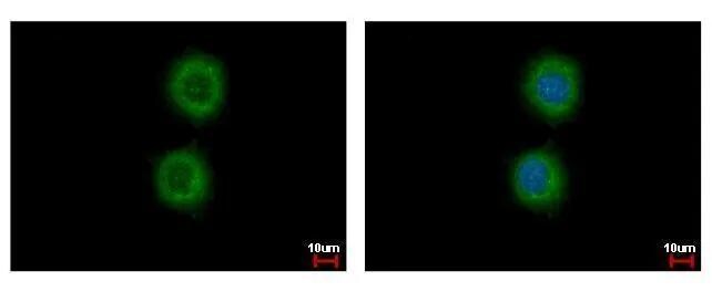Cytokeratin 72 Antibody - BSA Free