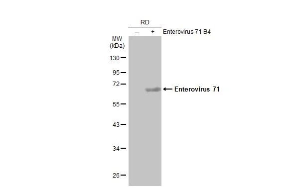 Enterovirus 71 Antibody