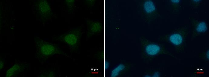 Histone H2B Antibody