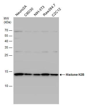 Histone H2B Antibody