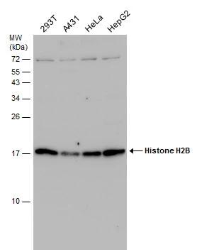 Histone H2B Antibody