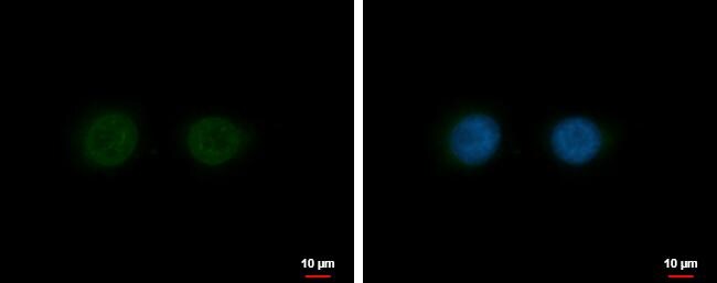 Nesprin 2 Antibody
