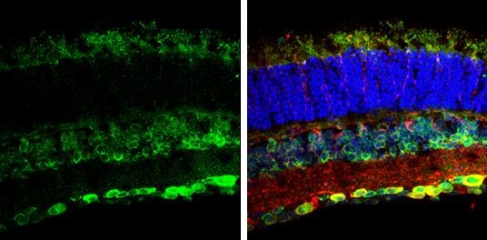Nesprin 2 Antibody