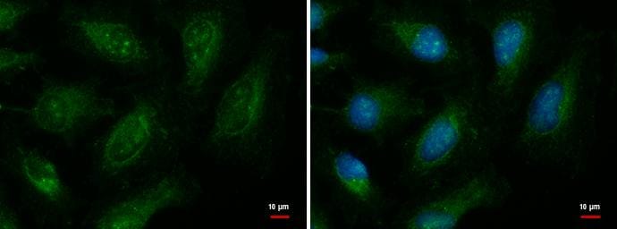 EXOC8 Antibody - BSA Free