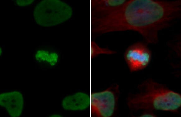 HIST1H3A [ac Lys18] Antibody