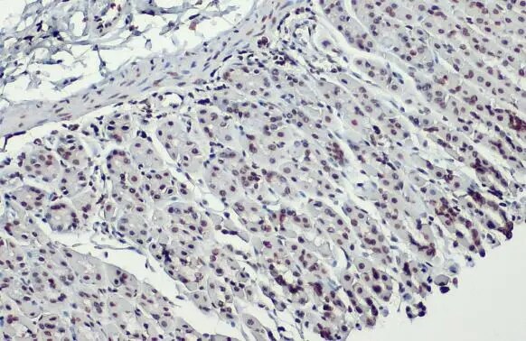 HIST1H3A [ac Lys18] Antibody