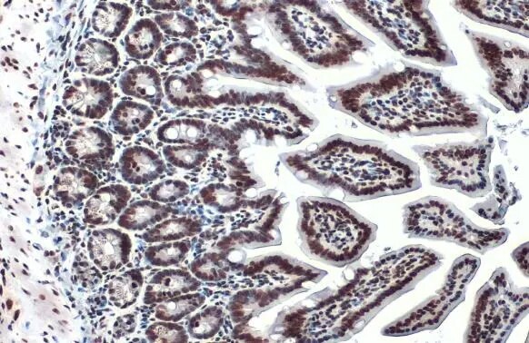HIST1H3A [ac Lys18] Antibody