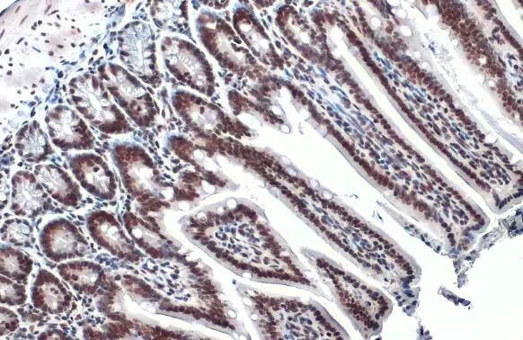 HIST1H3A [ac Lys18] Antibody