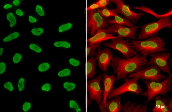 HIST1H3A [ac Lys18] Antibody