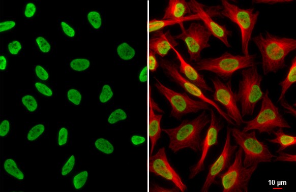 HIST1H3A [ac Lys18] Antibody
