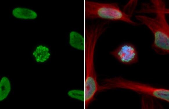 HIST1H3A [ac Lys18] Antibody