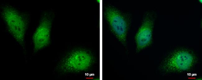 HKDC1 Antibody - BSA Free