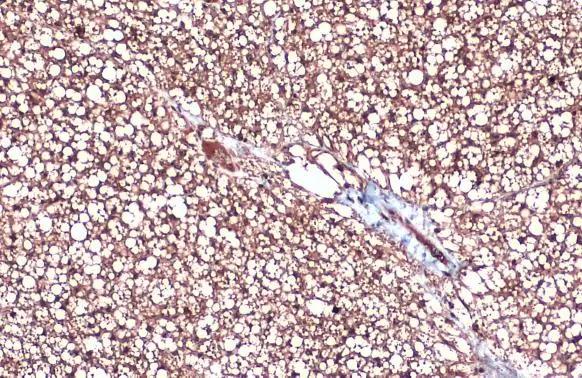 UCP1 Antibody (3111) - Azide and BSA Free