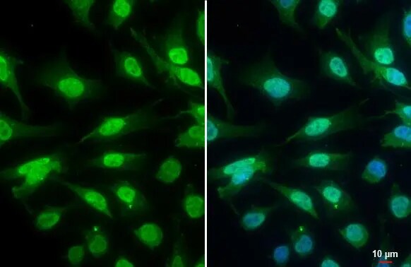 ATR [p Thr1989] Antibody (222)