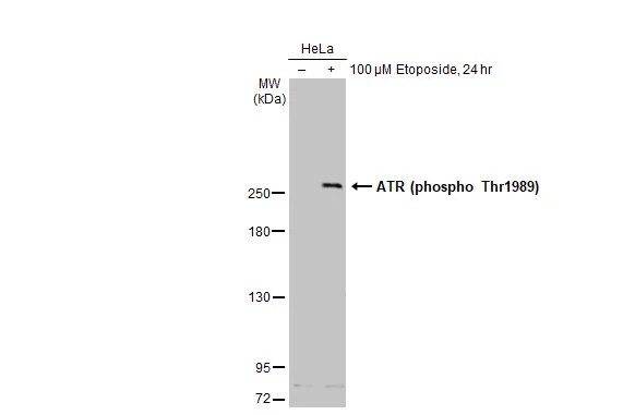 ATR [p Thr1989] Antibody (222)