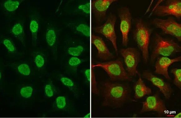 ATR [p Thr1989] Antibody (222)