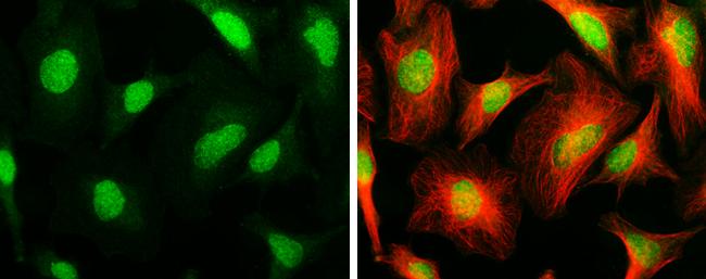 ARID1A Antibody (3611) - Azide and BSA Free