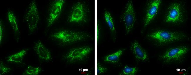 Fumarase Antibody (7612) - Azide and BSA Free