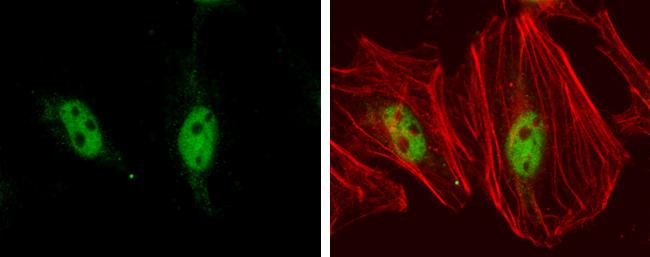 TEAD1 Antibody (13112) - Azide and BSA Free