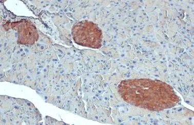 O-GlcNAc Transferase p110 subunit Antibody (678)