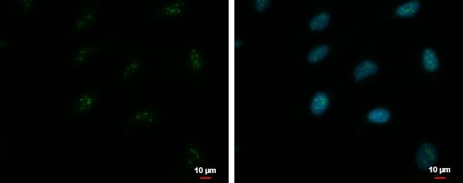 ZNF556 Antibody - BSA Free